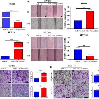 MiR 1224 5p Inhibits The Migration And Invasion Of CRC Cells In Vitro