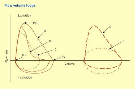 Tests Of Pulmonary Function Before Surgery Anaesthesia Intensive