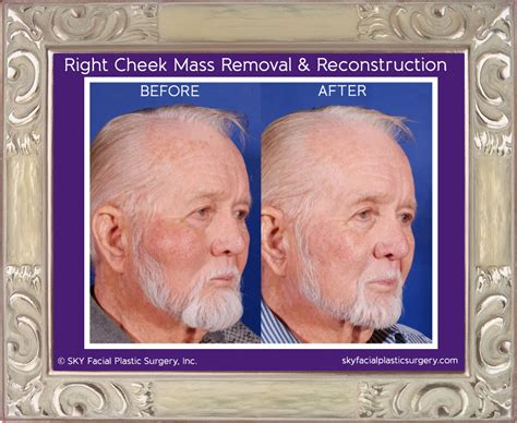 Reconstructive Surgery — Sky Facial Plastic Surgery