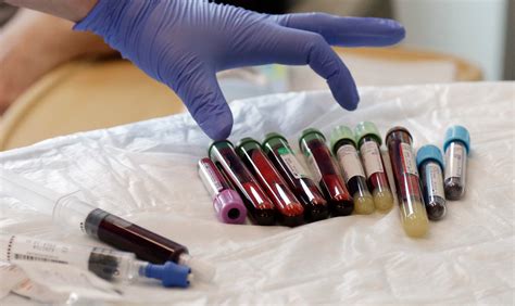 Unraveling misinformation about cancer clinical trials - WPR