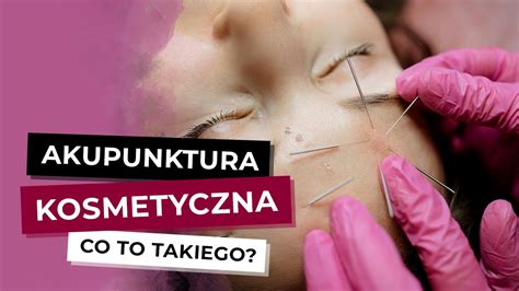 Akupunktura Kosmetyczna Czym Jest Akupunktura Kosmetyczna Akupunktura