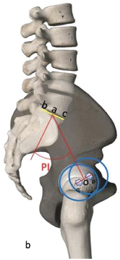 Scielo Brasil Sagittal Alignment Concepts And Spinopelvic Parameters Sagittal Alignment