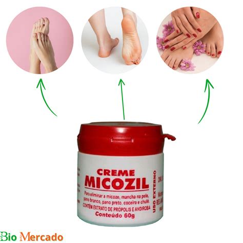 Qual A Melhor Pomada Para Micose - KIT 06 Pomada Creme Micozil 50g - Combate Micoses | Shopee Brasil
