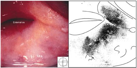 Sandy Patch Appearing As A Homogenous Yellow Area The Homogeneous