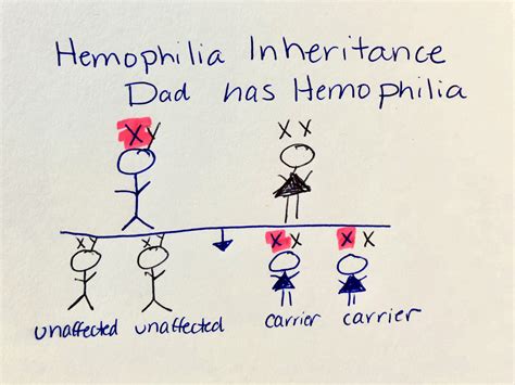 Illustrations of Hemophilia Inheritance Patterns Need Updating