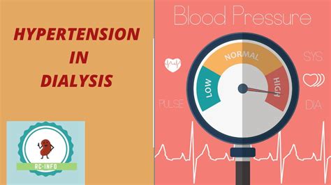 Hypertension In Dialysis Hypertension During Hemodialysis