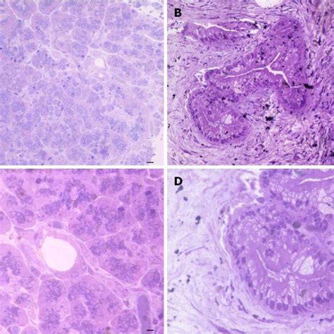 Semi Thin Sections Of Control And Pancreatic Ductal Adenocarcinoma