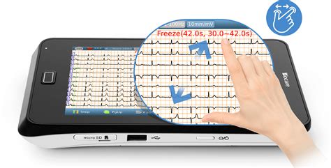 Point Of Care Lead Ecg Ekg Machine Based On A Tablet With Auto