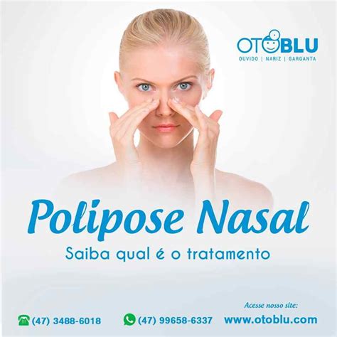 Polipose Nasal Clínica de Otorrino em Blumenau