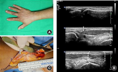 Figure 1 From Usefulness Of Ultrasonography In Diagnosis And Management