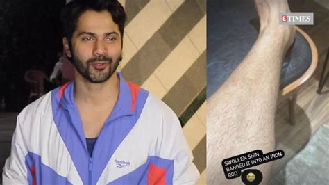 Varun Dhawan Gets Injured Again While Shooting For Atlee S Film Bangs