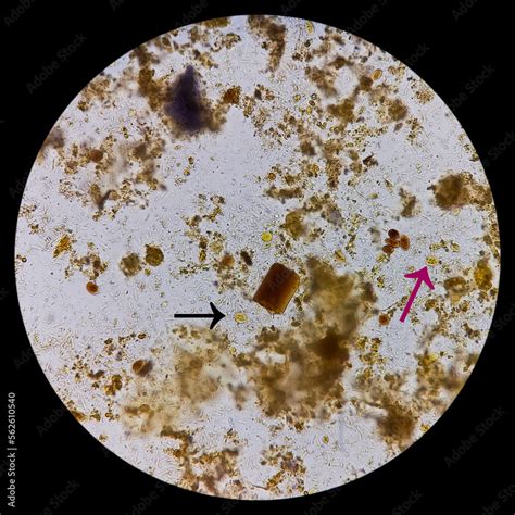 Giardia Lamblia Cysts And Trophozoite Form Muscle Fiber In Stool Examination Under 40x Light