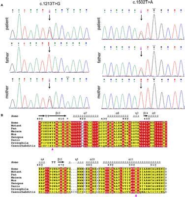 Frontiers Typical Pantothenate Kinase Associated Neurodegeneration