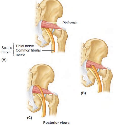 Piriformis Ql Iliopsoas And Deep Gluteal Syndrome Flashcards Quizlet