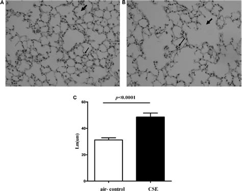 Cigarette Smoke Exposure Cse Induced Alveolar Destruction And