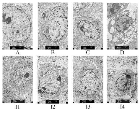 Western Blotting And Qrt Pcr For Zonula Occludens 1 Claudin 1 And