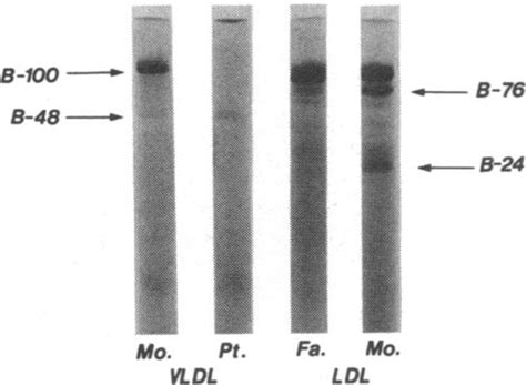 Sds Polyacrylamide Gel Electrophoretograms Of P Download Scientific