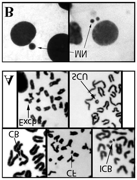 Photomicrographs Showing Bone Marrow Metaphase Chromosome Spreads With