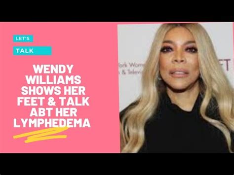 Wendy Williams Shows Her Feet Talks Abt Her Lymphedema Youtube