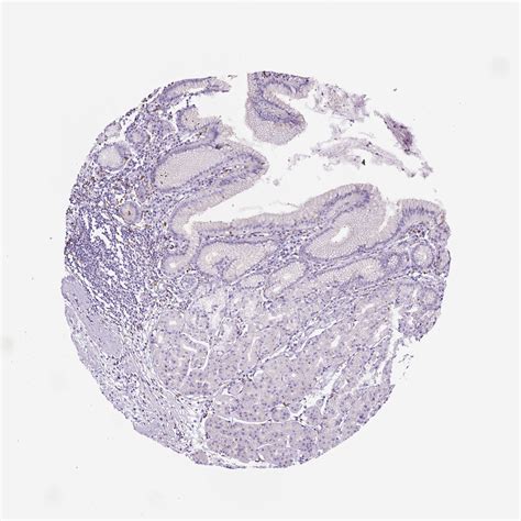 Tissue Expression Of Cd68 Staining In Stomach The Human Protein Atlas