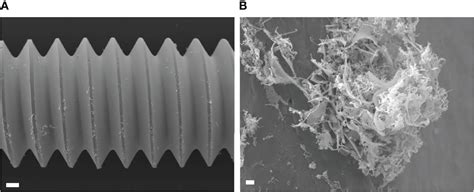 Frontiers Estimation Of Minimum Biofilm Eradication Concentration