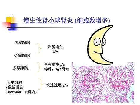 肾小球疾病概述word文档在线阅读与下载无忧文档