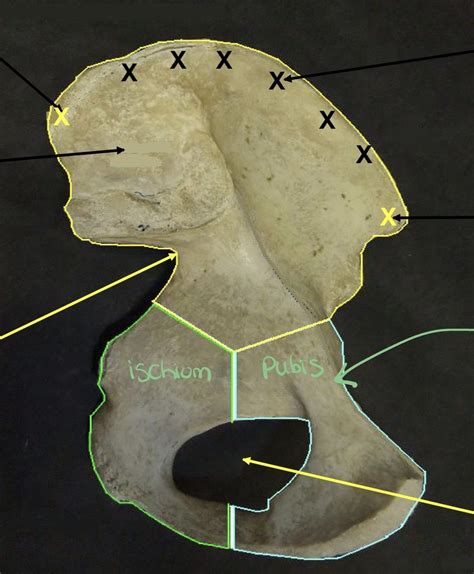 Coxal Bone Anteromedial 2 Diagram Quizlet