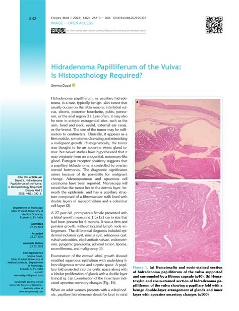 Pdf Hidradenoma Papilliferum Of The Vulva Is Histopathology Required