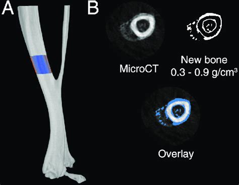 MicroCT Analysis Regions To Assess New Periosteal Bone Formation A