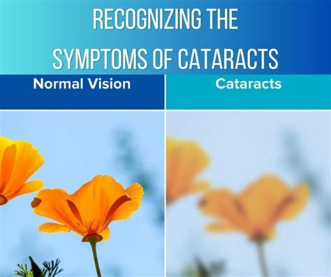 Recognizing The Symptoms Of Cataracts The Eye Center Of North Florida