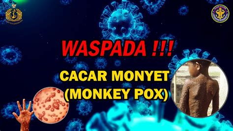 WASPADA CACAR MONYET MONKEY POX YouTube