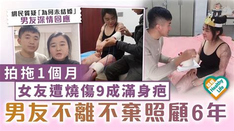 患難見真情︳拍拖1個月 女友遭燒傷9成滿身疤 男友不離不棄照顧6年 晴報 健康 生活健康 D230320