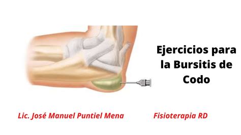 Los Mejores Ejercicios Para La Bursitis De Codo Fisioterapiard Youtube