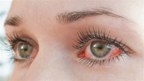 7 Home Remedies for Dry, Itchy Eyes - CNET