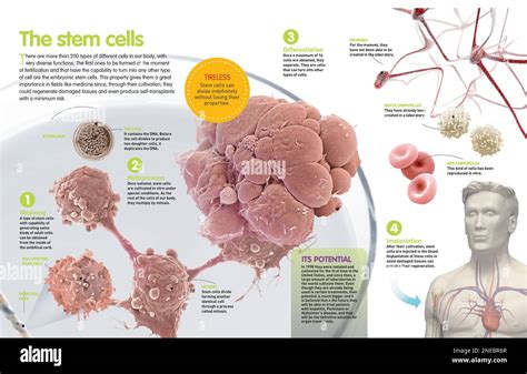 Infografía sobre las células madre y su utilidad en terapias médicas