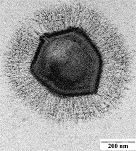 Giant Virus Discovered With Its Own Crispr Like Immune System