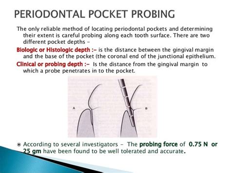 Periodontal Pocket