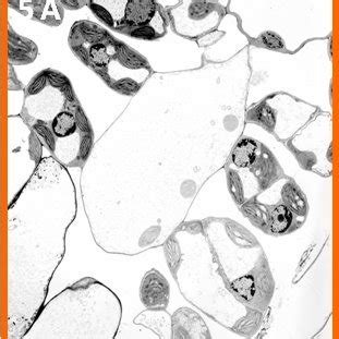 Electron Micrograph Of Kudzu Mesophyll Cells From Seedlings Treated