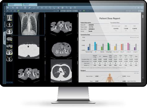 Medizinische Software INFINITT North America für Kliniken