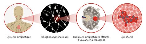 Sympt Mes Du Lymphome Cellules Du Manteau Lilly France