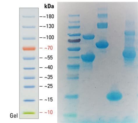 Solved Biochemistry Sds Page Identify Protein Bands Chegg