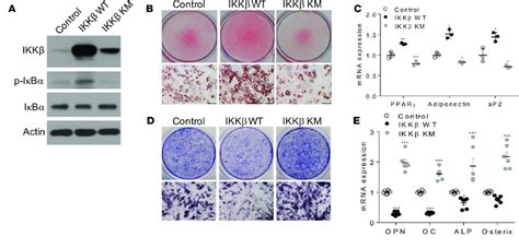 Overexpression Of Ikk Promotes Adipogenesis And Decreases Osteogenesis