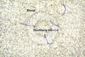 Dirofilaria immitis. Dirofilariasis. 125X - Nematoda (Nematodes ...