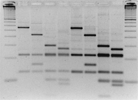 Comparison Of Restriction Patterns Of Four Pcr Amplified S S Rdna