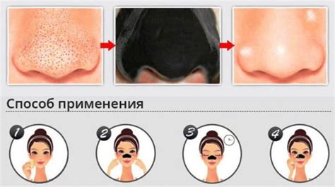 Как избавиться от черных точек на носу дома навсегда, рецепты масок