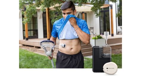 Tandem Mobi Automated Insulin Pump Now Pairs With Dexcom G7 Cgm