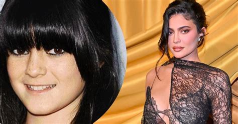 Everything Kylie Jenner Has Said About Her Persistent Plastic Surgery