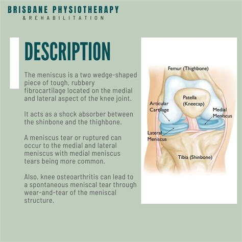 What is a Meniscus Injury? - Brisbane Physiotherapy