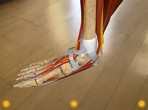 App hämophile Arthropathie MedicalGraphics