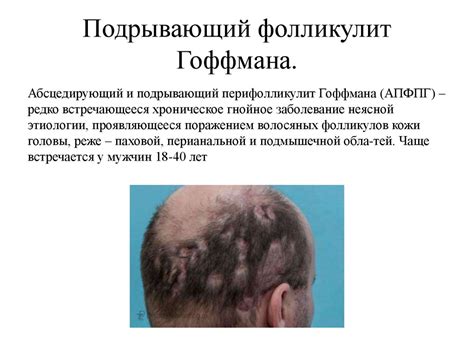 Патология волос и кожи волосистой части головы - online presentation